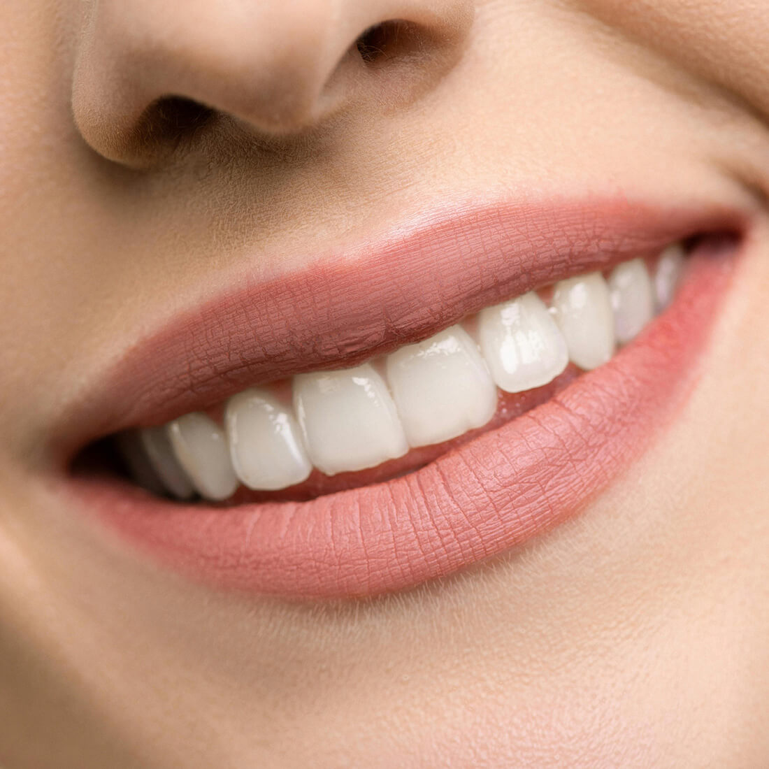 Tandimplantat Göteborg